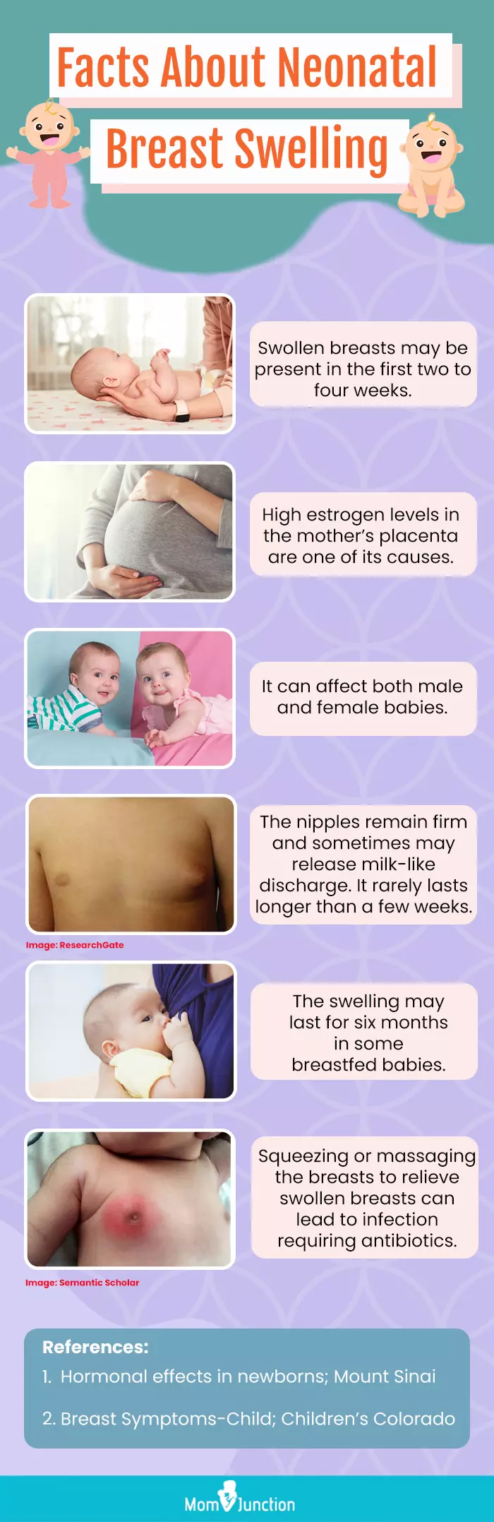 4 Unexpected Causes Of Swollen Breasts In Newborns MomJunction