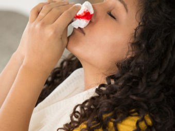 Nosebleeds During Pregnancy: Causes And Ways To Stop Them