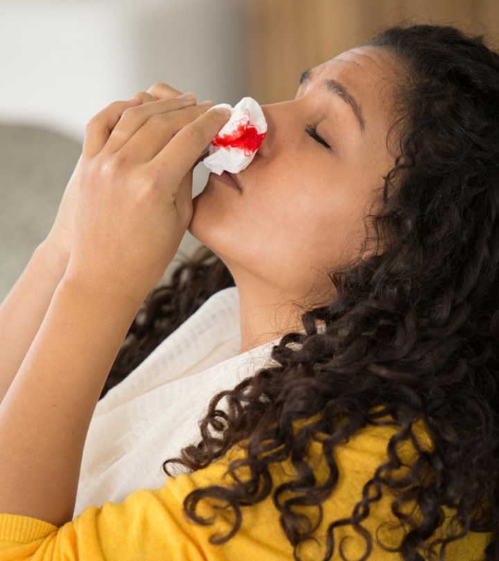 Nosebleeds During Pregnancy Causes And Ways