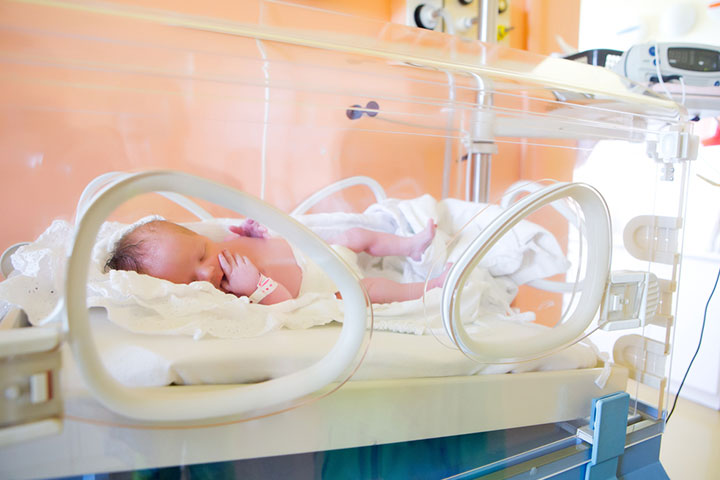 Respiratory distress in term and preterm infants