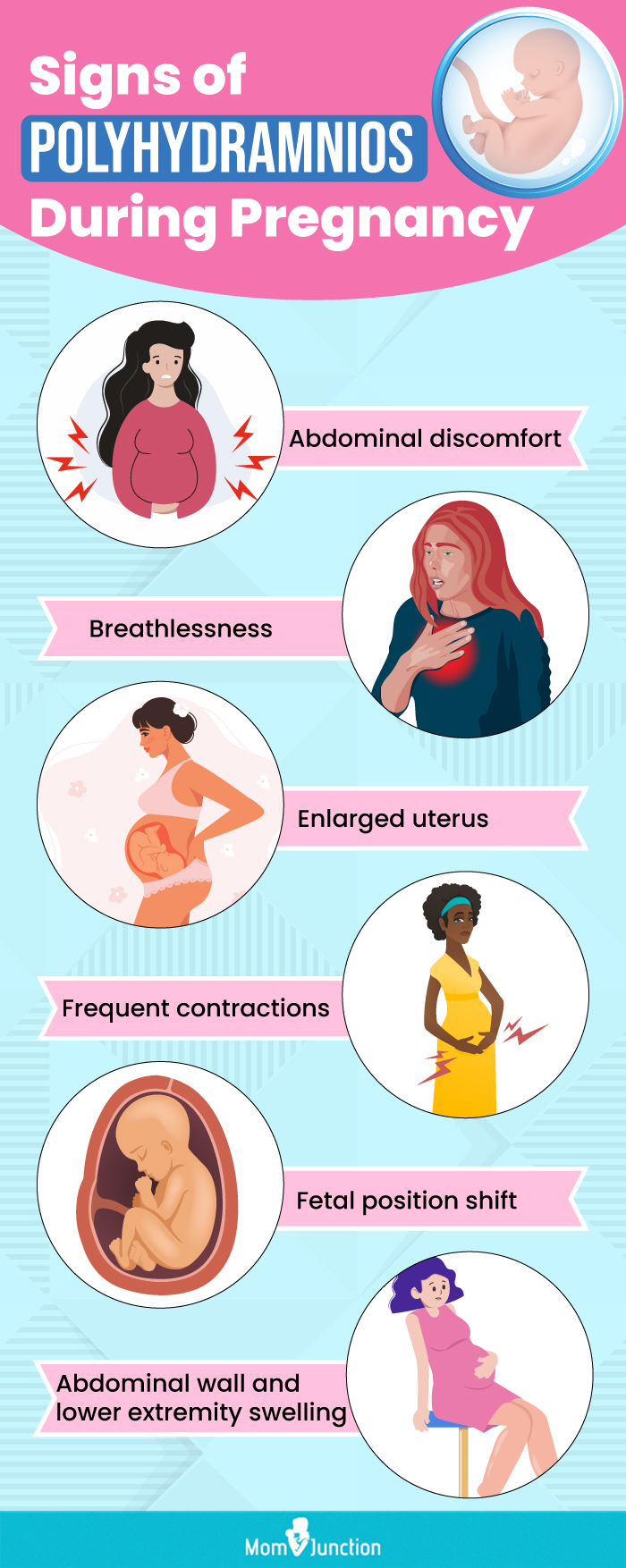 signs of polyhydramnios during pregnancy (infographic)