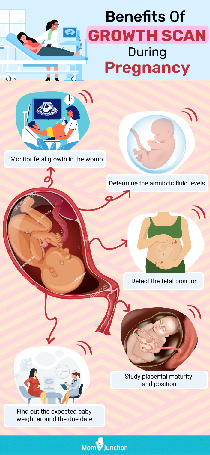 growth scan during the third trimester (infographic)