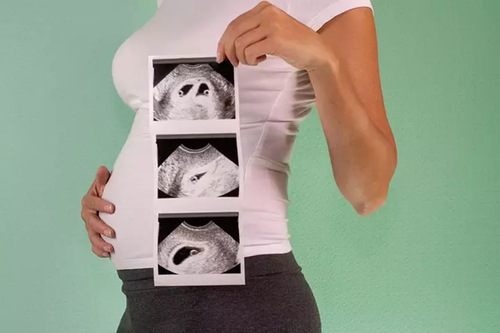 When Can You Find Out If You’re Having Twins Or Multiples