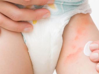 five best ways to prevent a diaper rash