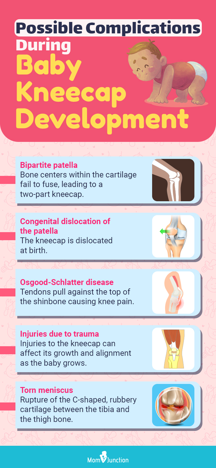 possible complications during baby kneecap development(infographic)