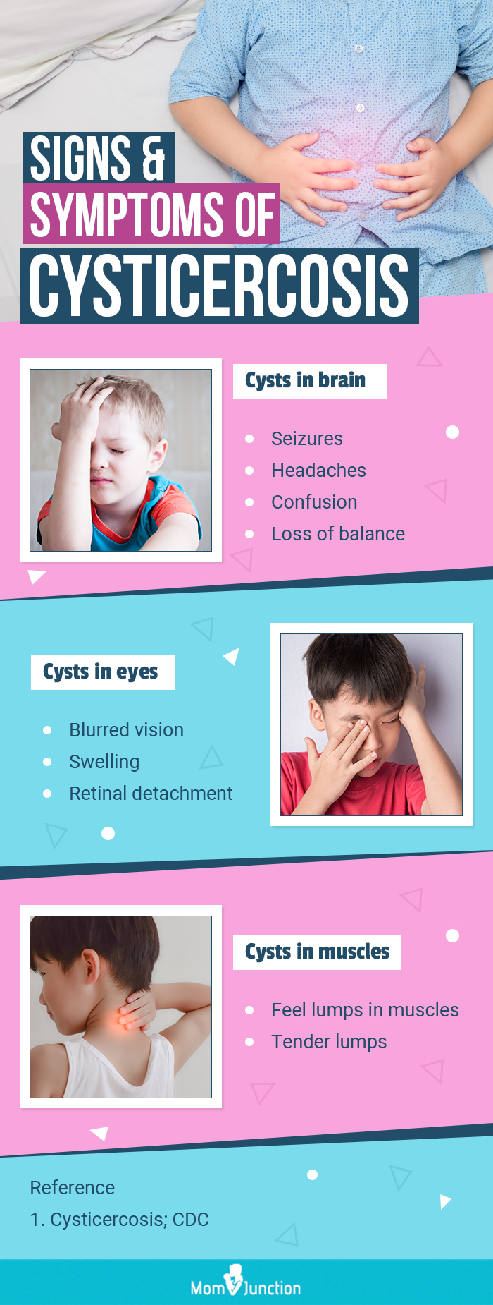 signs and symptoms of cysticercosis (infographic)