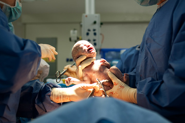 There Is A Difference Between Emergency C Sections And Unplanned C Sections