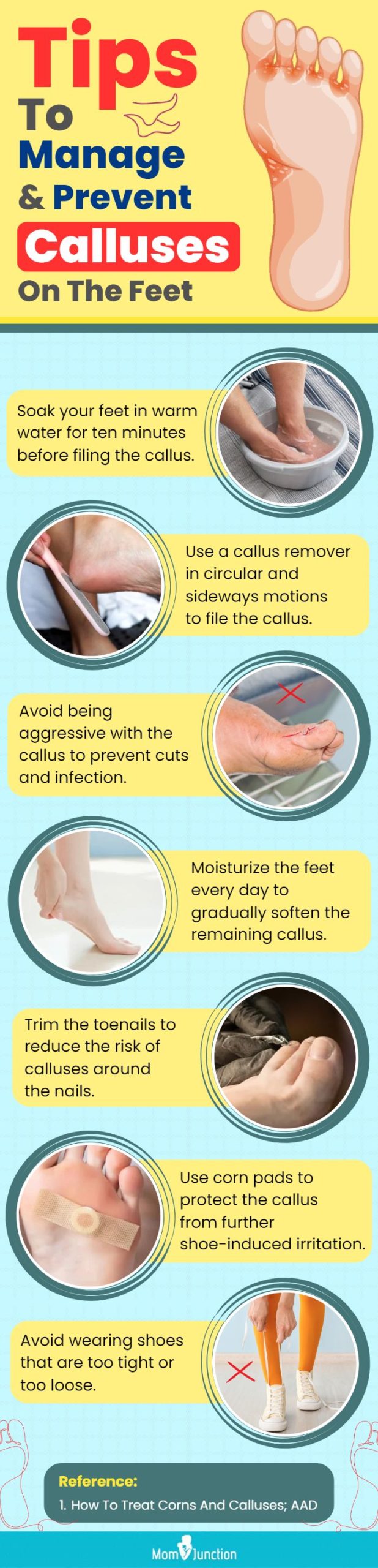 Tips To Manage And Prevent Calluses On The Feet (infographic)