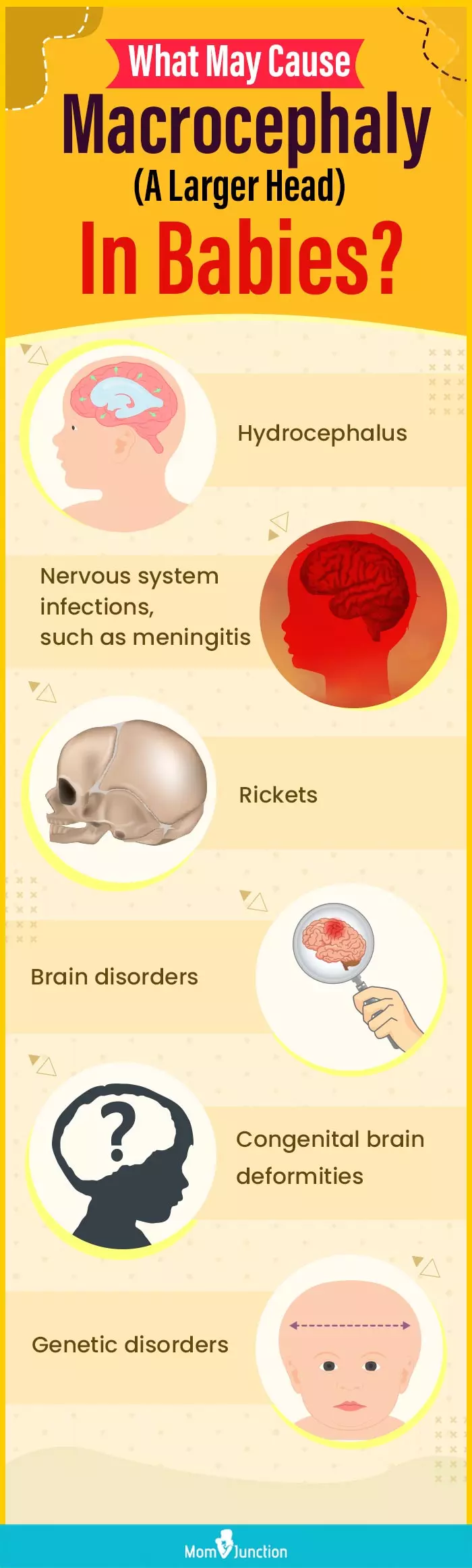 what may cause macrocephaly (a larger head) in babies (infographic)
