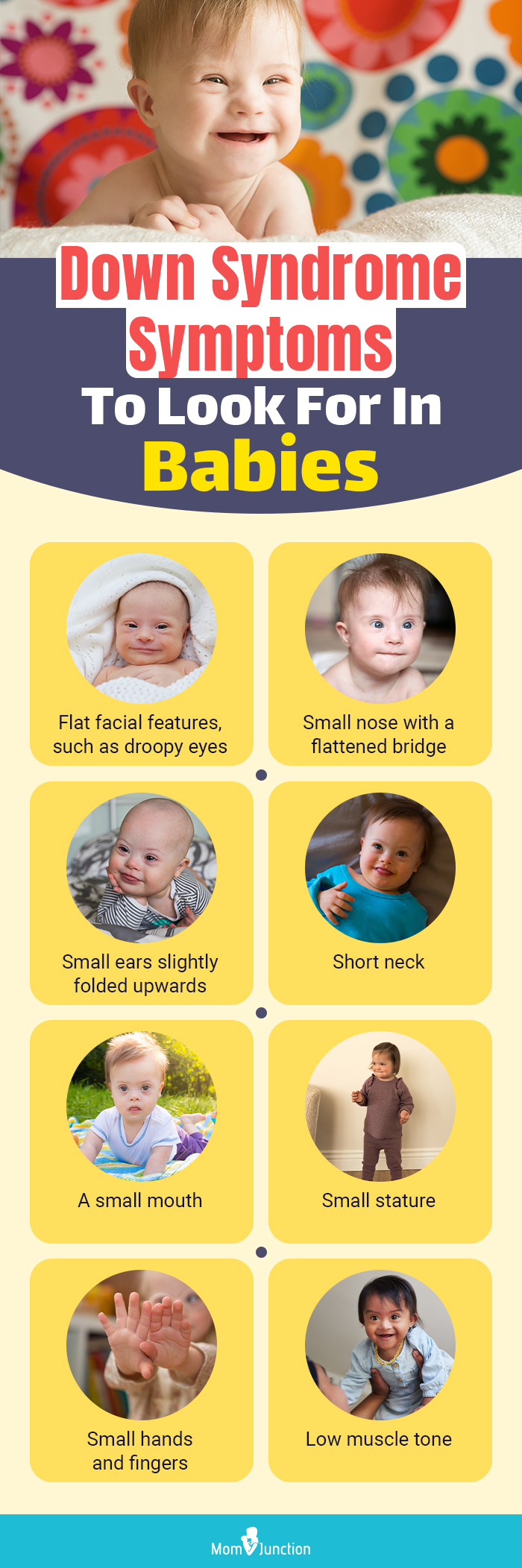 down syndrome symptoms to look for in babies (infographic)