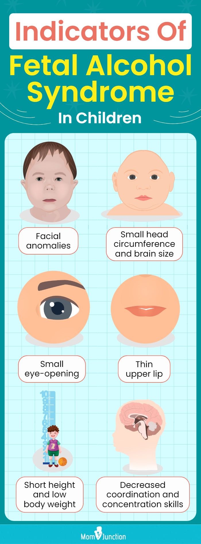 indicators of fetal alcohol syndrome in children (infographic)