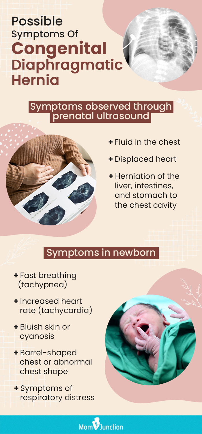 possible symptoms of congenital diaphragmatic hernia (infographic)
