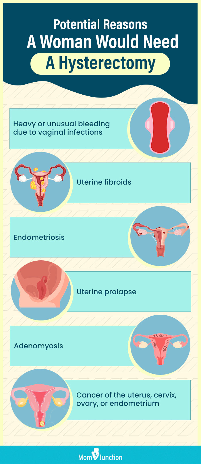 potential reasons a woman would need a hysterectomy (infographic)