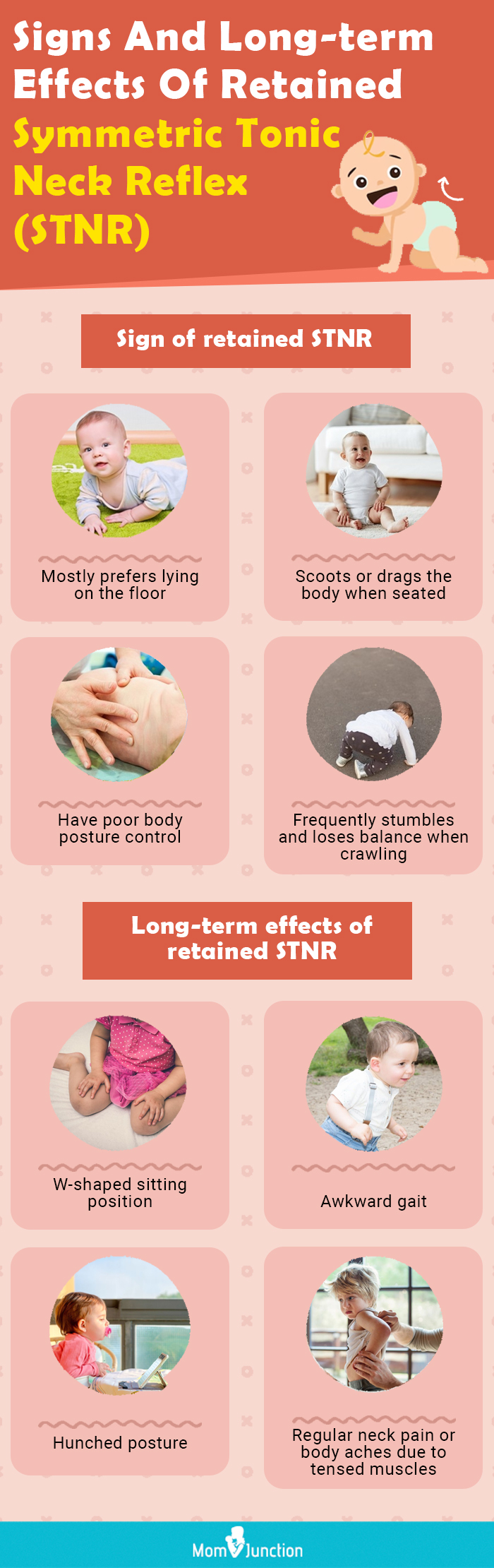 signs and long term effects of retained symmetric tonic neck reflex (stnr) (infographic)