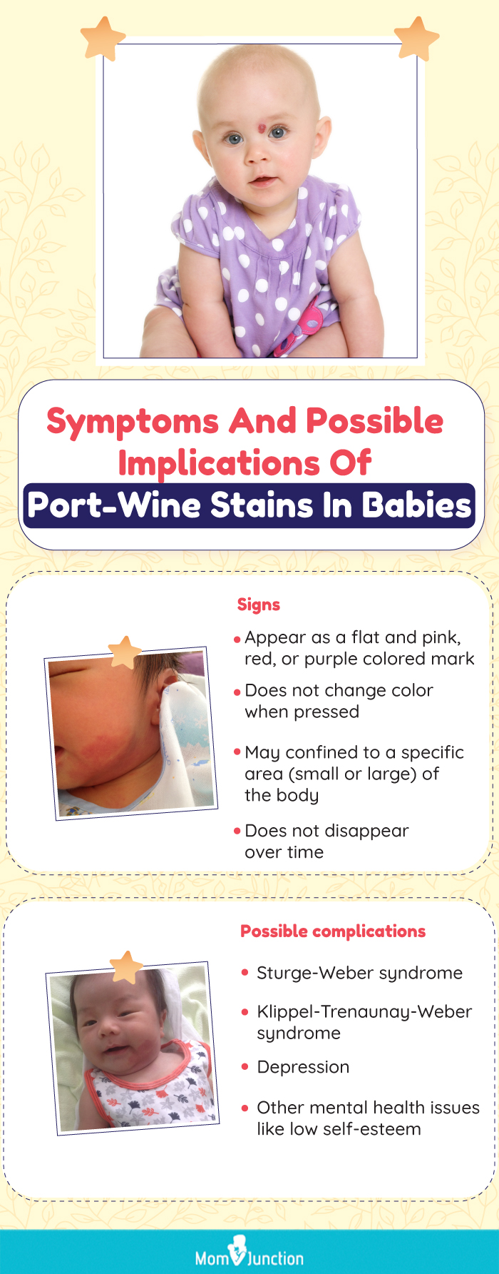 symptoms and possible implications of port wine stains in babies (infographic)