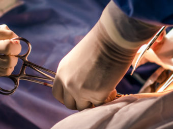 All You Need To Know About C-Section