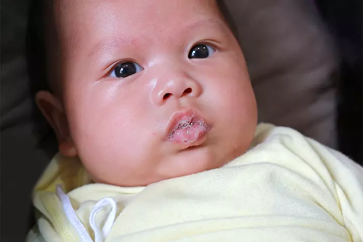 How to Tell If Your Baby's Spit-Up Is Vomit