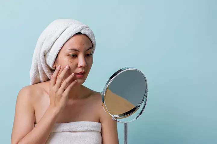 Is It Normal To Have Melasma During Pregnancy