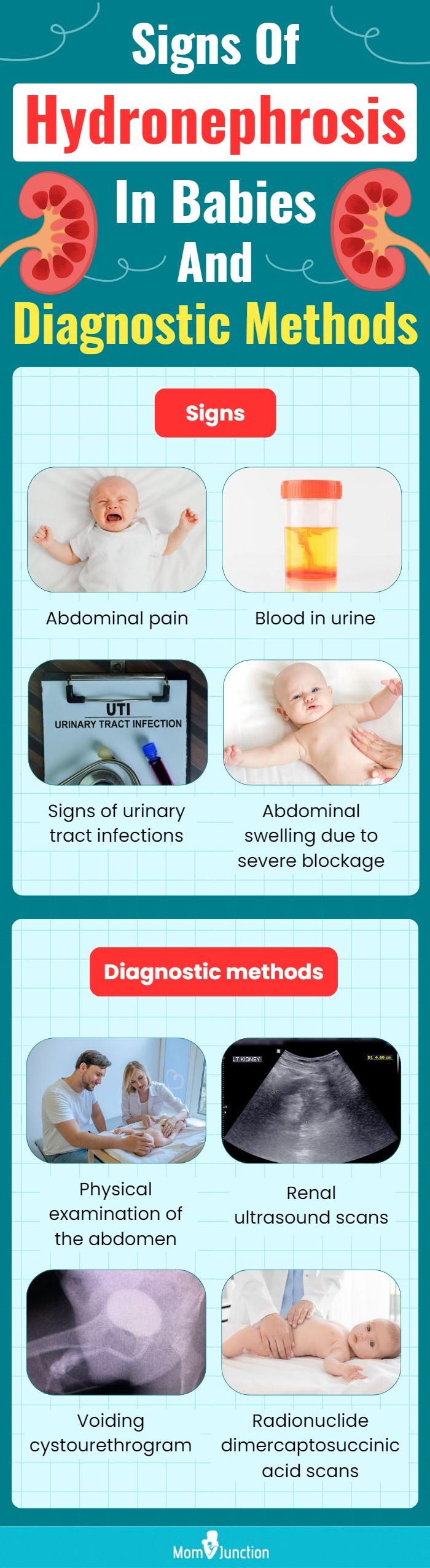 signs of hydronephrosis in babies and diagnostic methods (infographic)