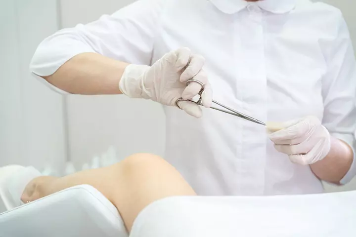 How Common Is Forceps Delivery