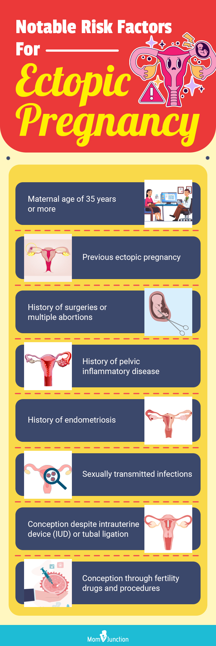 notable risk factors for ectopic pregnancy (infographic)