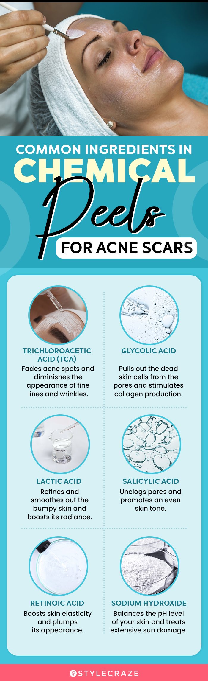 Common Ingredients In Chemical Peels For Acne Scars (infographic)
