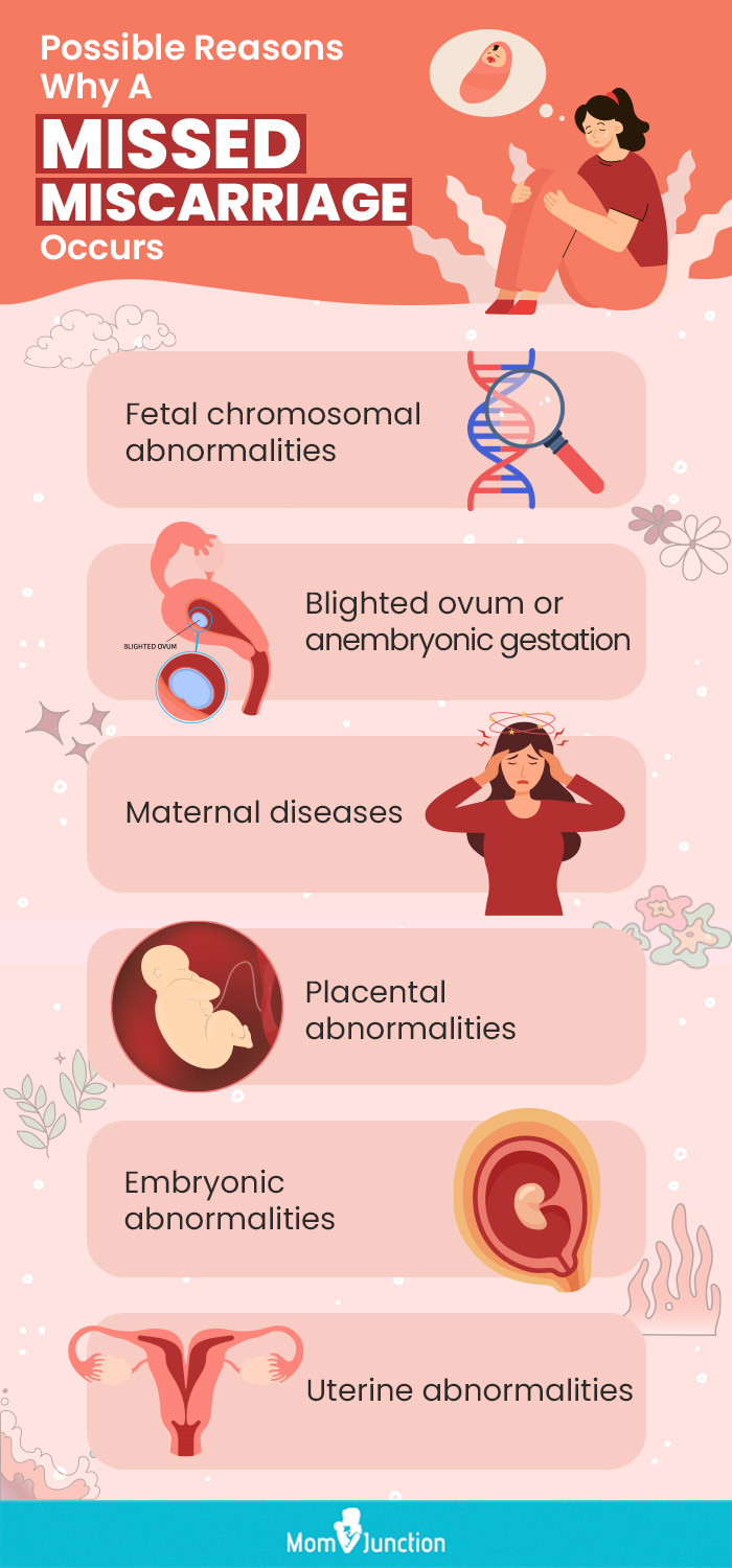 possible reasons why a missed miscarriage occurs (infographic)