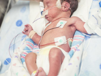 A List Of Things That Mothers Of Premature Kids Should Be Aware Of