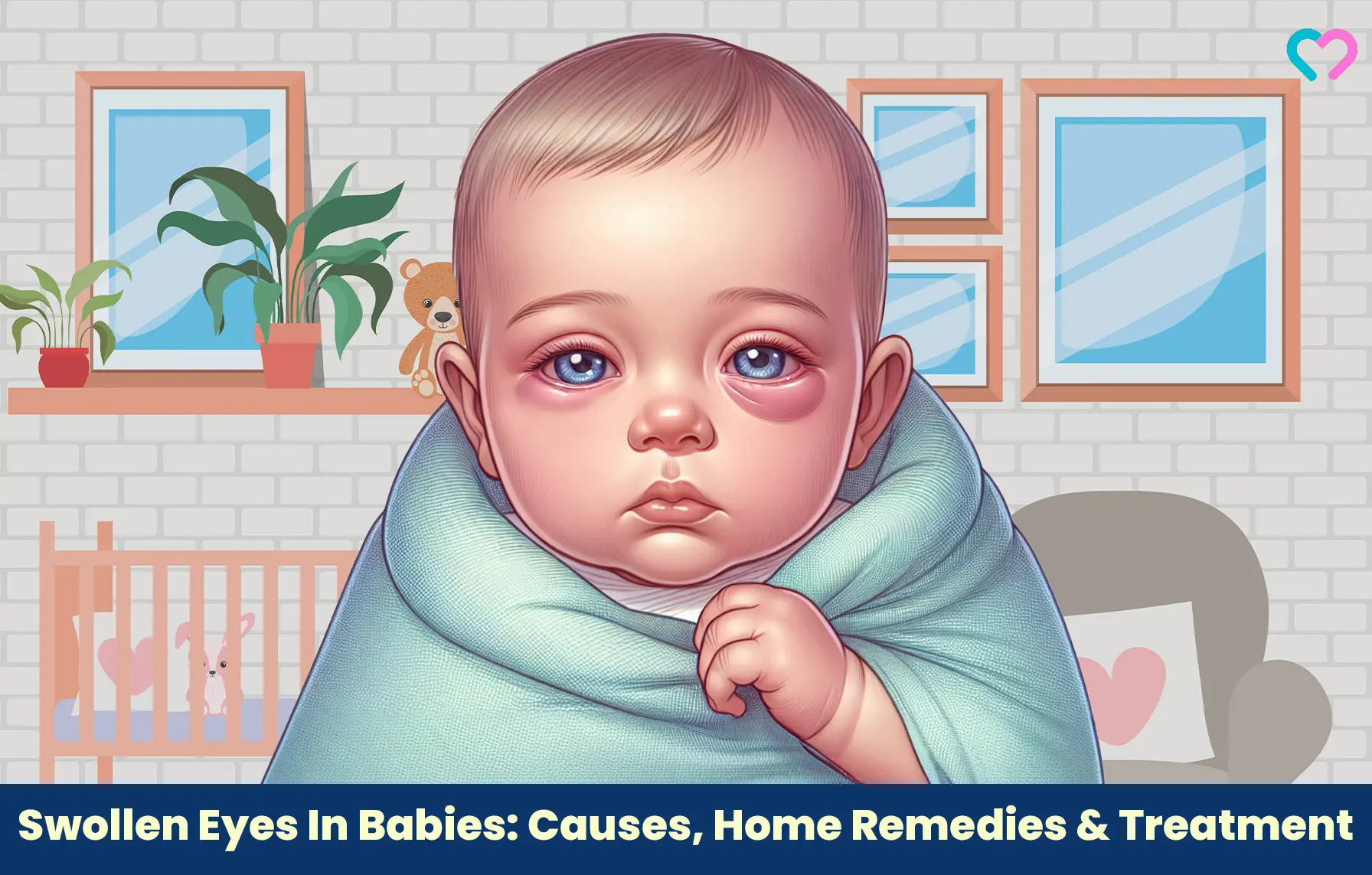 Swollen Eyes In Babies: Causes, Home Remedies & Treatment_illustration