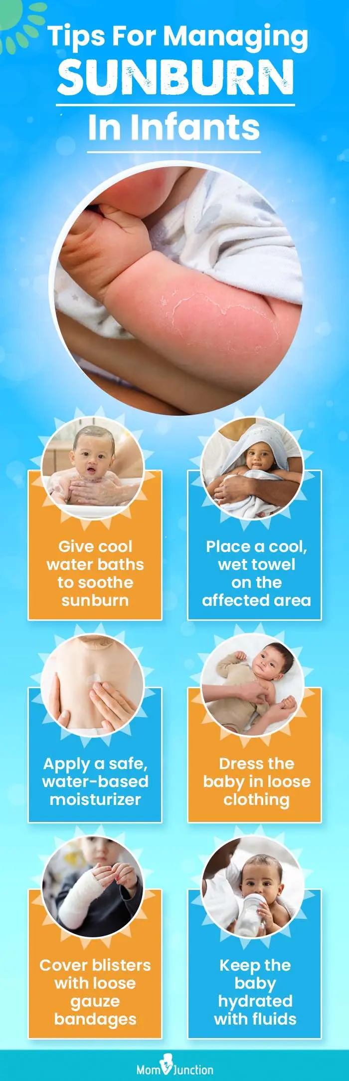 tips for managing sunburn in infants (infographic)