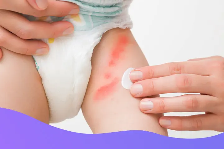 Keep Monsoon Skin Calm with Protective, pH-Smart Care