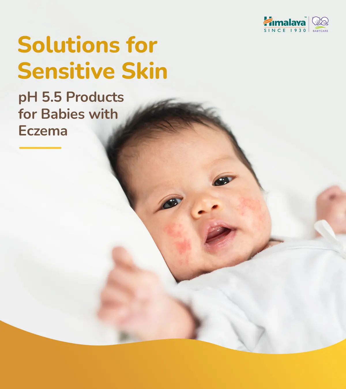 Solutions for Sensitive Skin: pH 5.5 Products for Babies with Eczema Products for Babies with Eczema