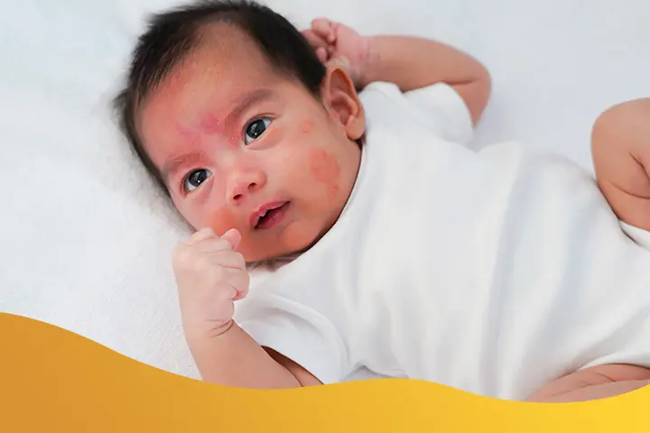 Recognizing Truly Sensitive Skin
