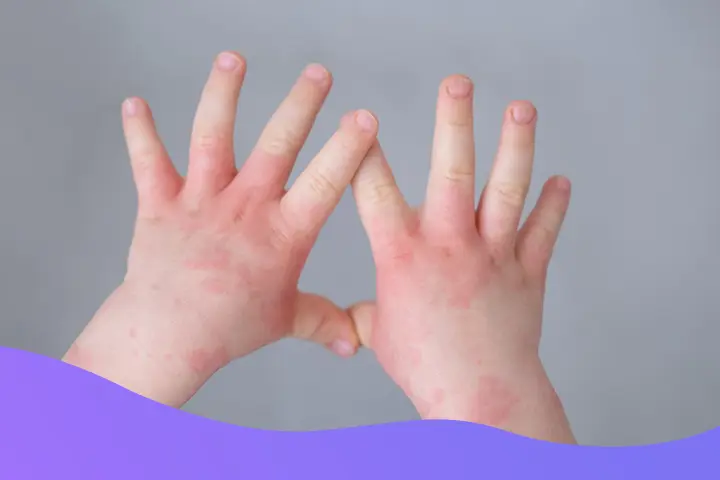 What Pediatricians Say About Baby Skin Health
