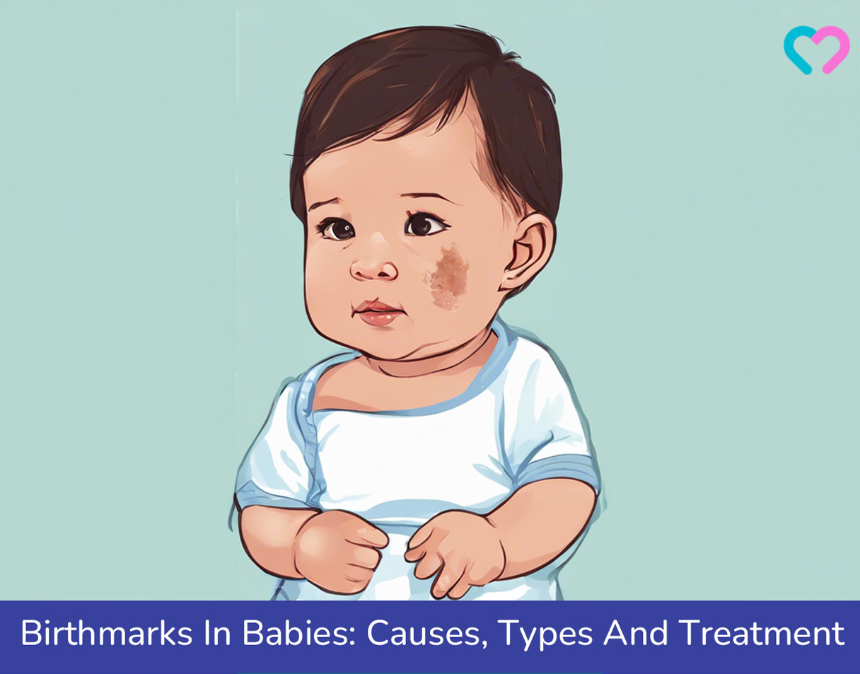 Birthmarks In Babies_illustration