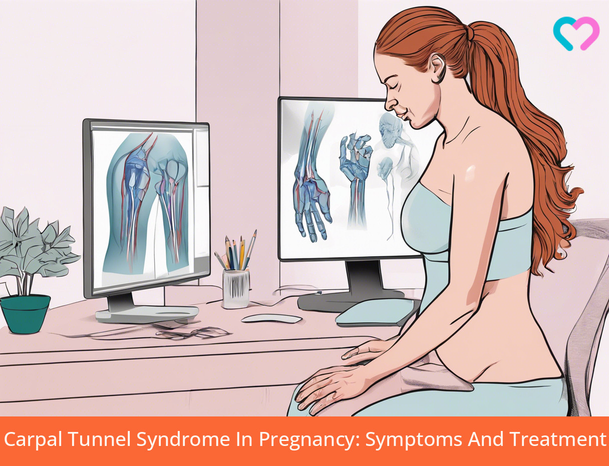 Carpal Tunnel Syndrome In Pregnancy_illustration