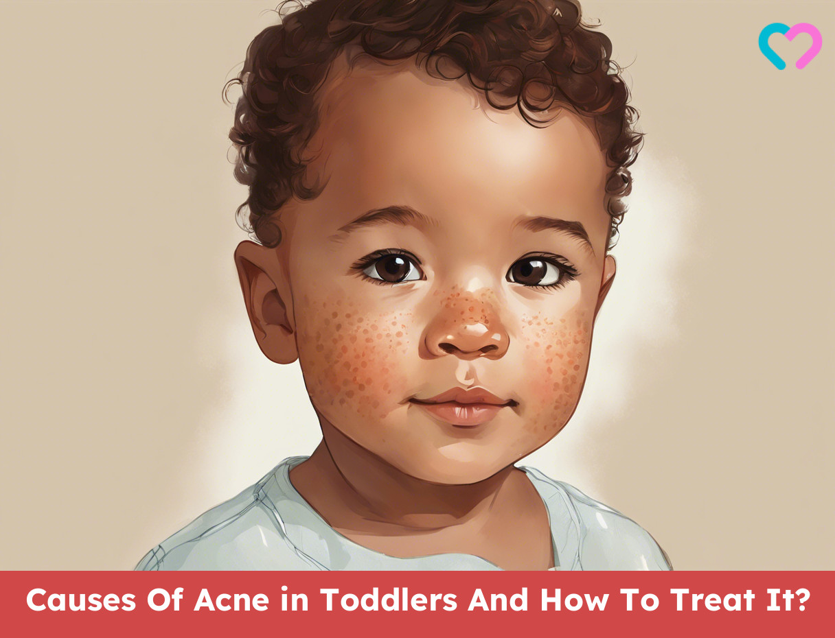 Toddler Acne_illustration
