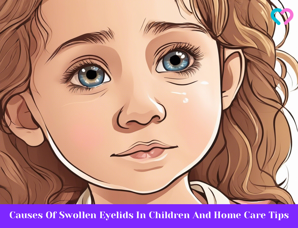Swollen Eyelids In Children_illustration