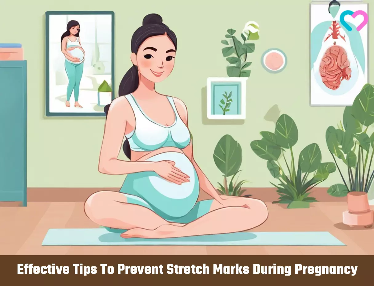 How to prevent stretch marks during pregnancy_illustration