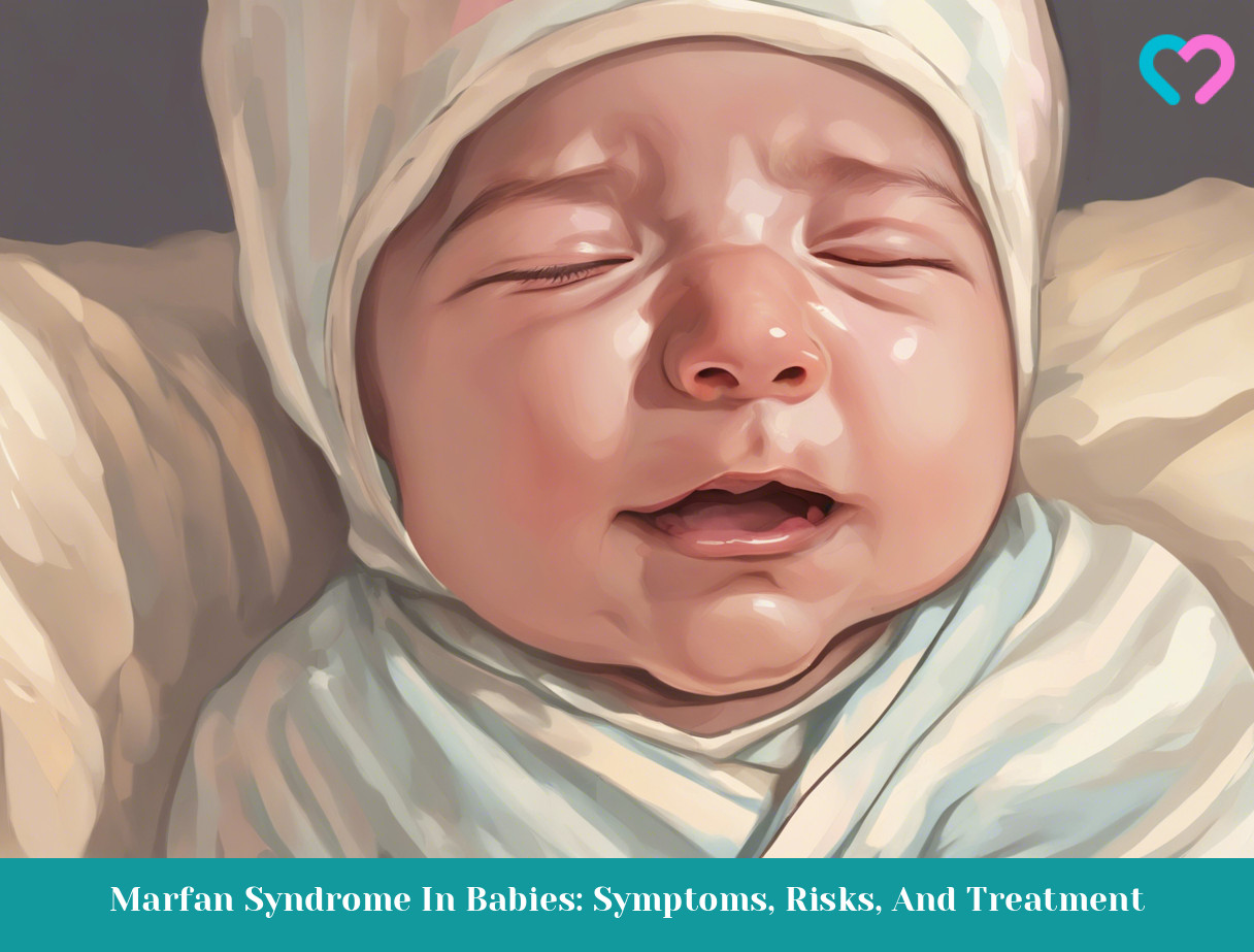 Marfan Syndrome In Babies_illustration