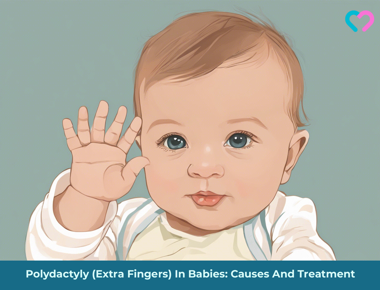 polydactyl on babies_illustration