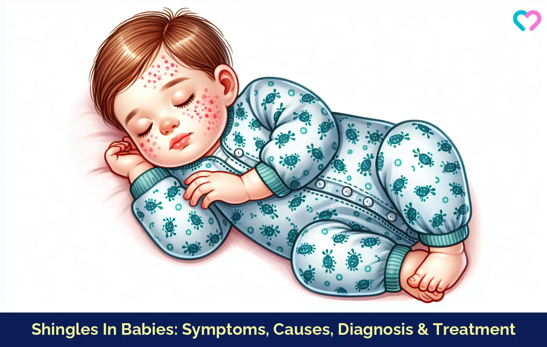 Shingles In Babies_illustration