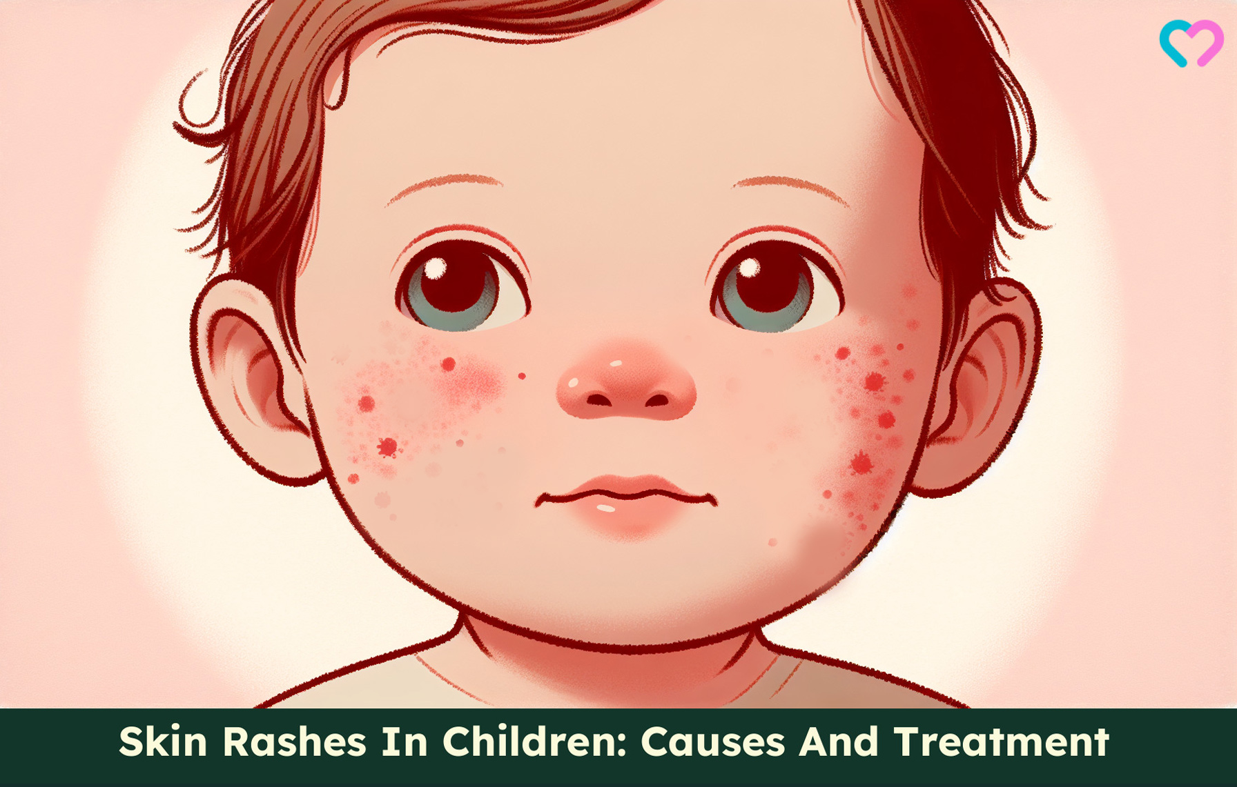 Skin Rashes In Children_illustration