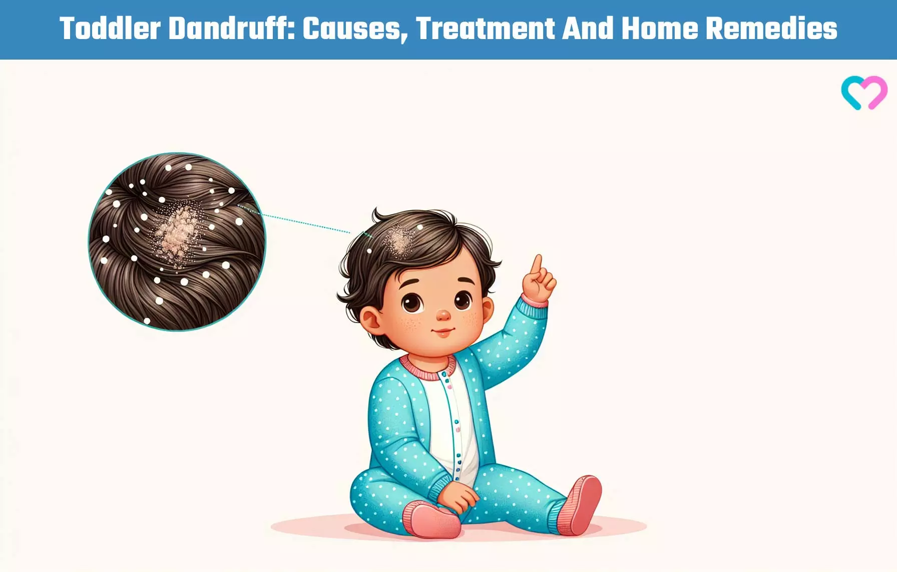 Dandruff In Toddlers_illustration