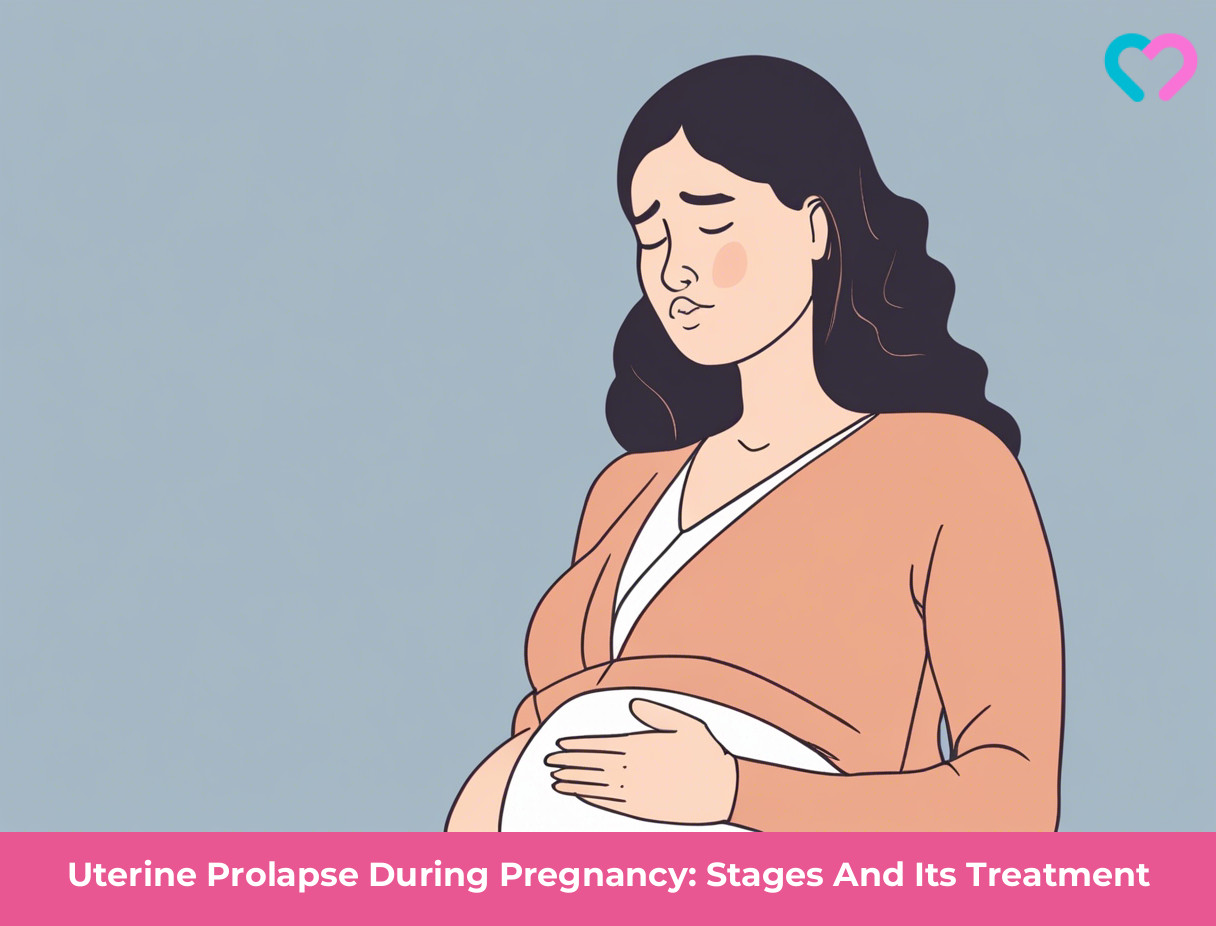 Uterine Prolapse During Pregnancy_illustration
